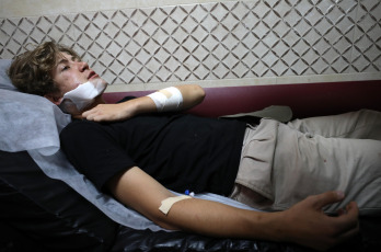 Naplusa, Palestina.- En las fotos, voluntarios extranjeros heridos son atendidos en el Hospital Rafidia en la ciudad cisjordana de Naplusa, el 22 de julio de 2024. Cuatro activistas pro palestinos, entre ellos tres extranjeros, resultaron heridos este domingo cuando un grupo de colonos israelíes armados con palos y varas de hierro los atacó al sur de Cisjordania, según medios palestinos.